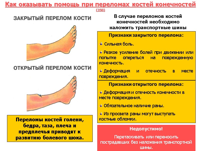 Как оказывать помощь при переломах костей конечностей (350) . В случае переломов костей конечностей